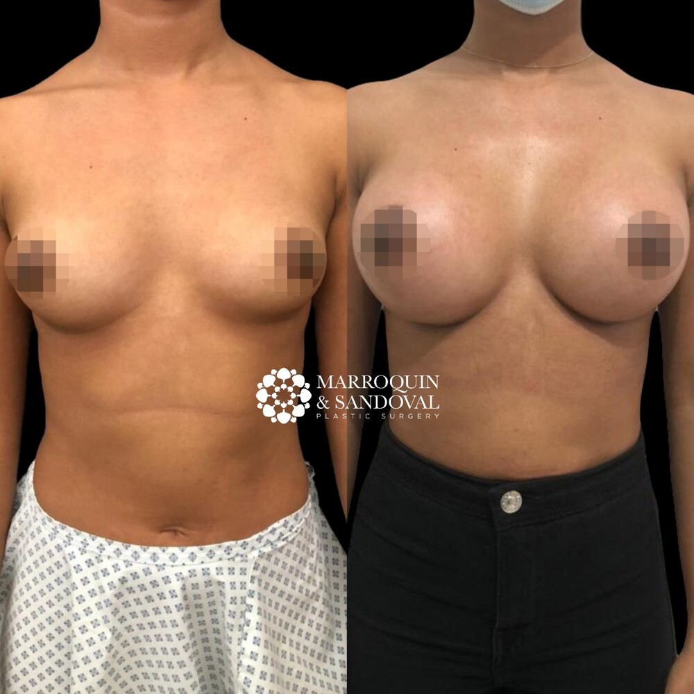 Clinic Results Gallery